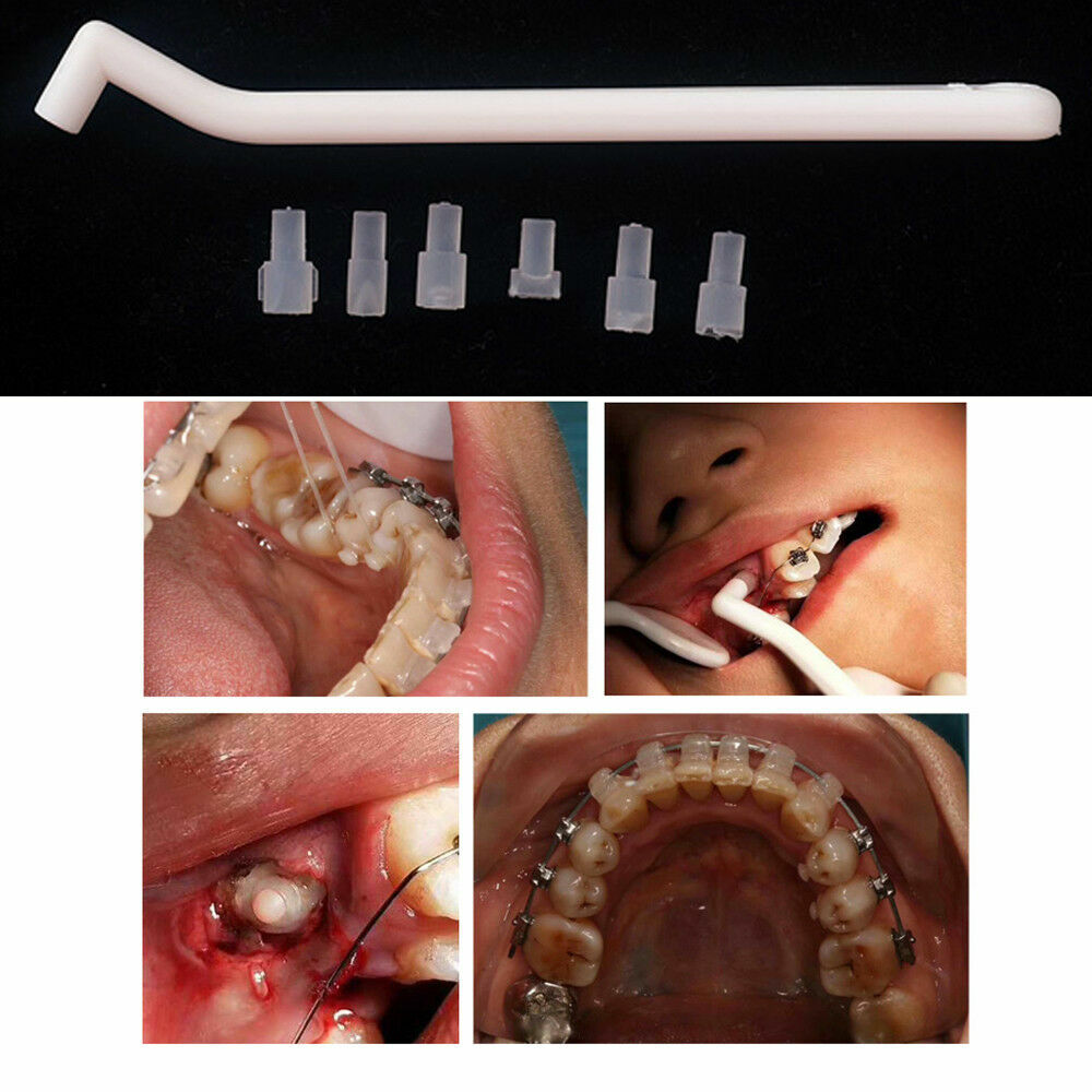 Dental Mini Orthodontic Mould Starter Injection Lingual Button Mold Bite Turbo
