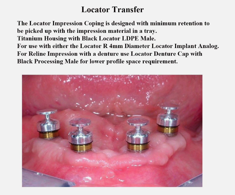 LOCATOR by Zest Impression Coping Transfer Abutment Overdenture Lab Use 4Pcs/bag