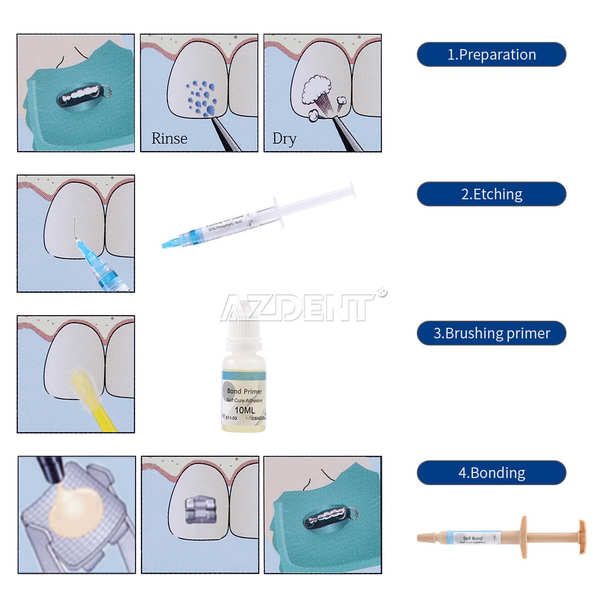Dental Orthodontic Brackets Light Cure Bonding Adhesive Etch Gel Bonding kit