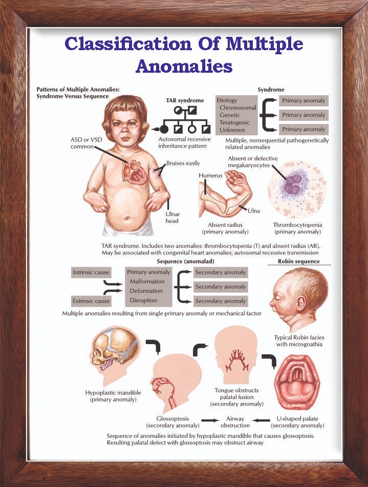 Classification Of Multiple Anomalies Chart 12×18 inches