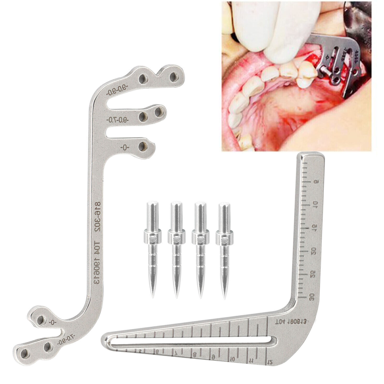 1 Kit Dental Implant Guide Tools Surgical Drill S/ L Type Depth Pin Instrument