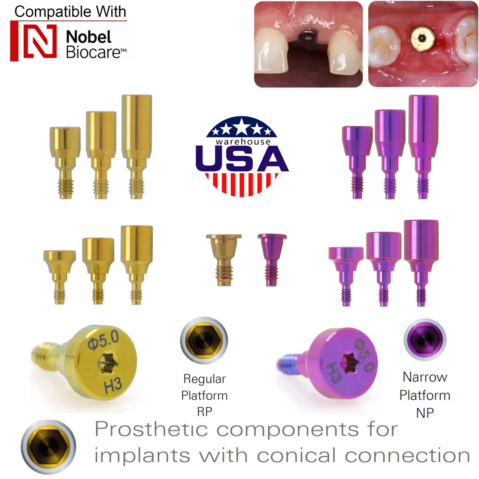 5Pcs Nobel active Healing Abutment Cover Screw Healing Screw Gum Molding Implant