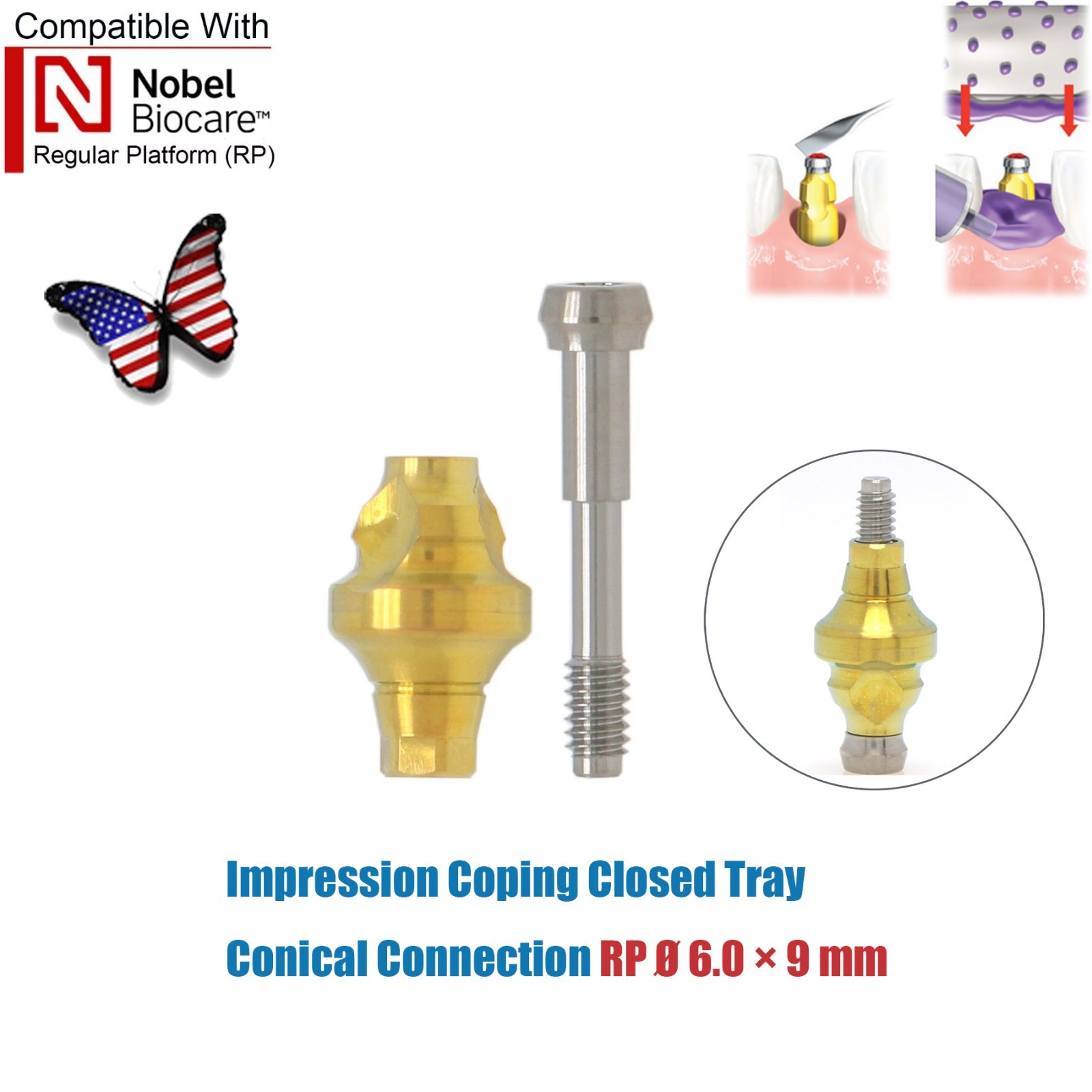 US Dental Nobel Biocare Open/Closed Tray Impression Coping/Analog/Scanbody NP RP