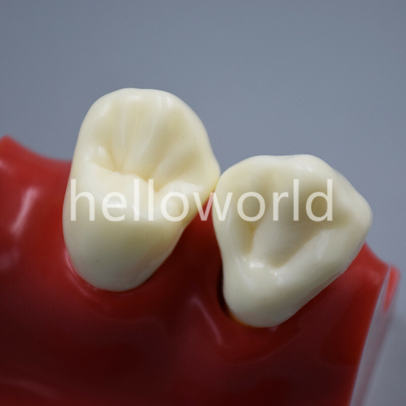 Dental Endodontic Study Teeth Model 4 Times Tooth Anatomy Anatomical Models