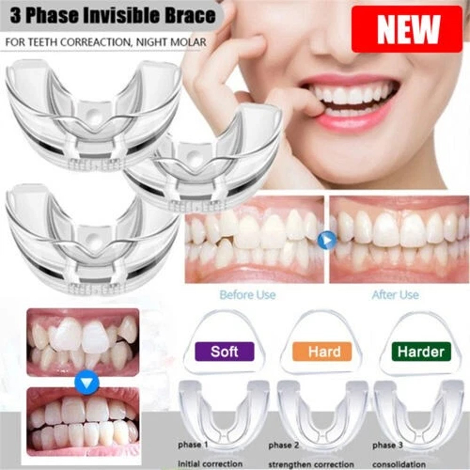 Dental Multifunctional Invisible Braces Orthodontic Smile Teeth Alignment Traine