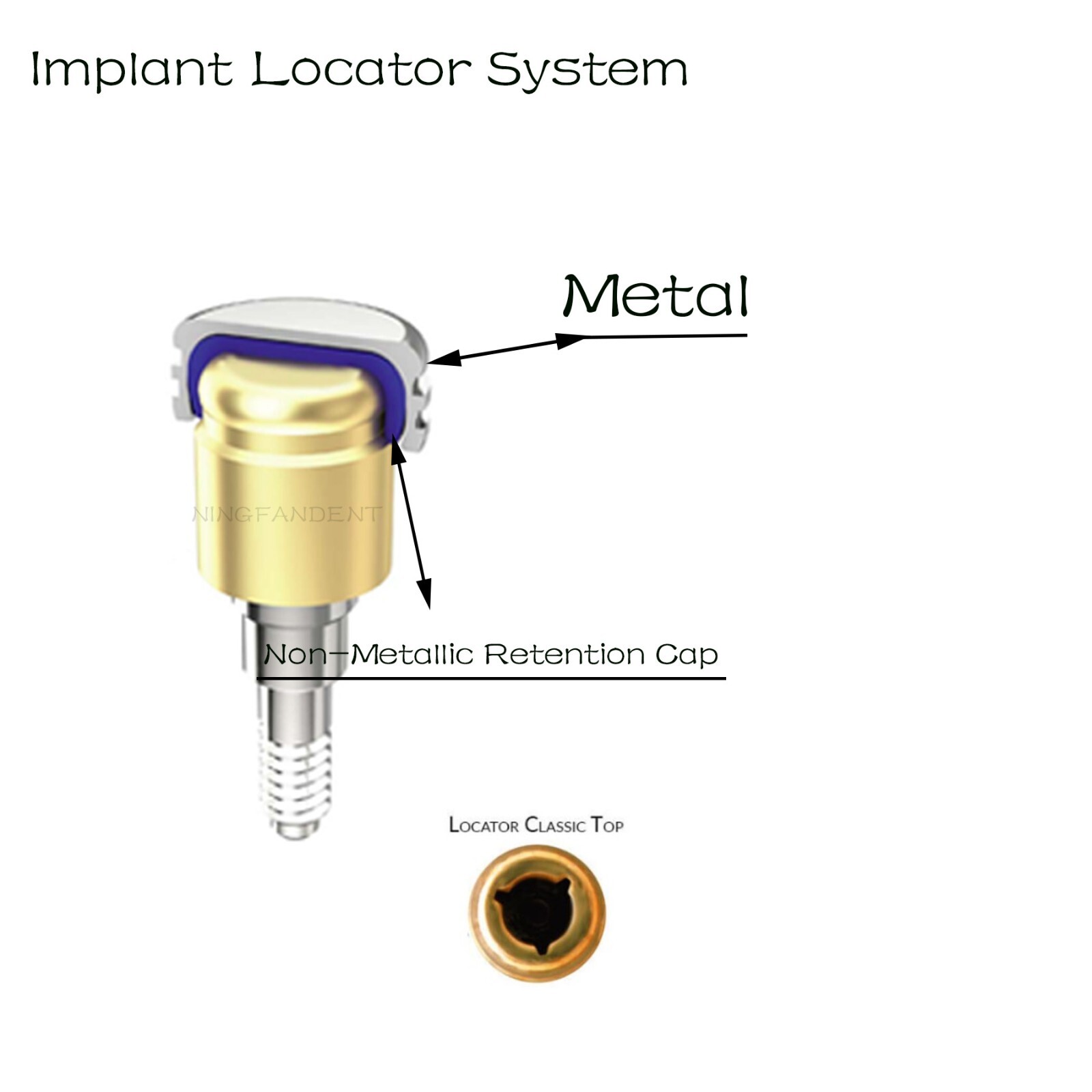 US Dental Zest locator Regular Platform fit Hiossen ET φ 4.0/4.5/5.0mm Implants