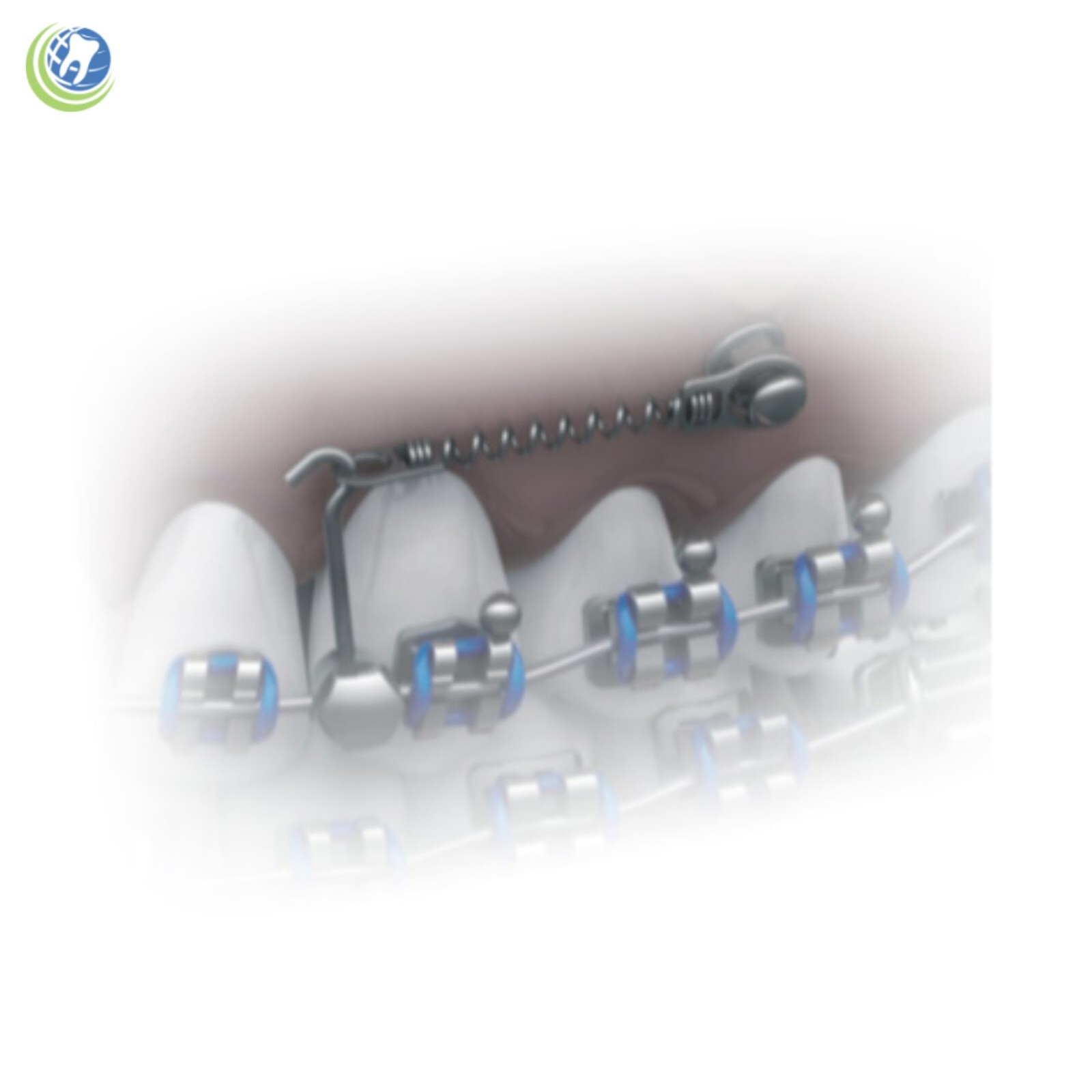 Orthodontic 9mm NiTi Closed Spring with Eyelets Ø1,60mm – Medium Force 200gf
