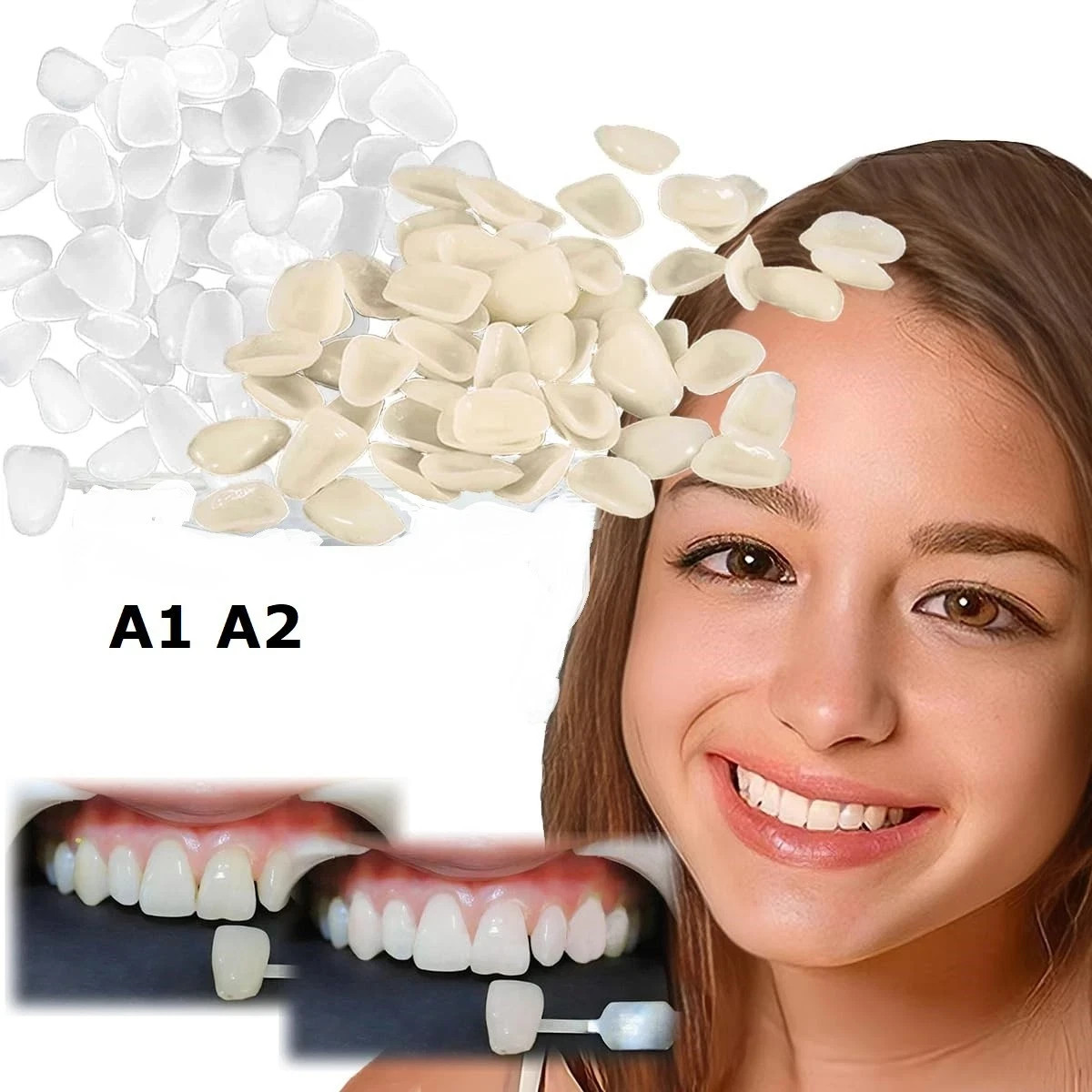 200Pcs Dental Temporary Crown Veneers for Anterior Front Teeth Whitening USA