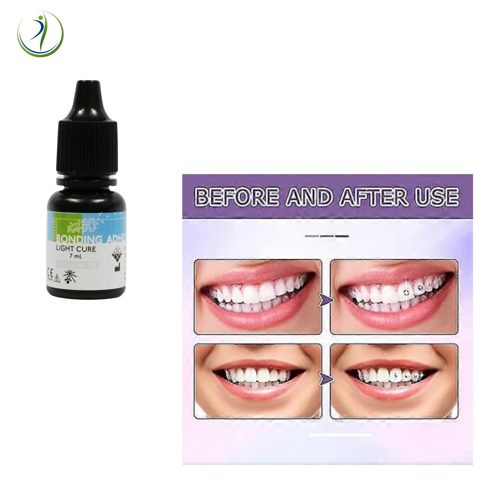 Professional Tooth Gem Rhinestone Placement Kit Materials — Stones Not Included