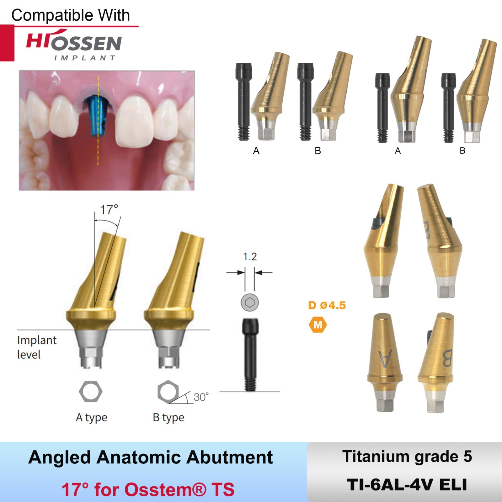 US Dental Straight Transfer & 17° Angled Anatomic Abutment Fit Hiossen/Osstem