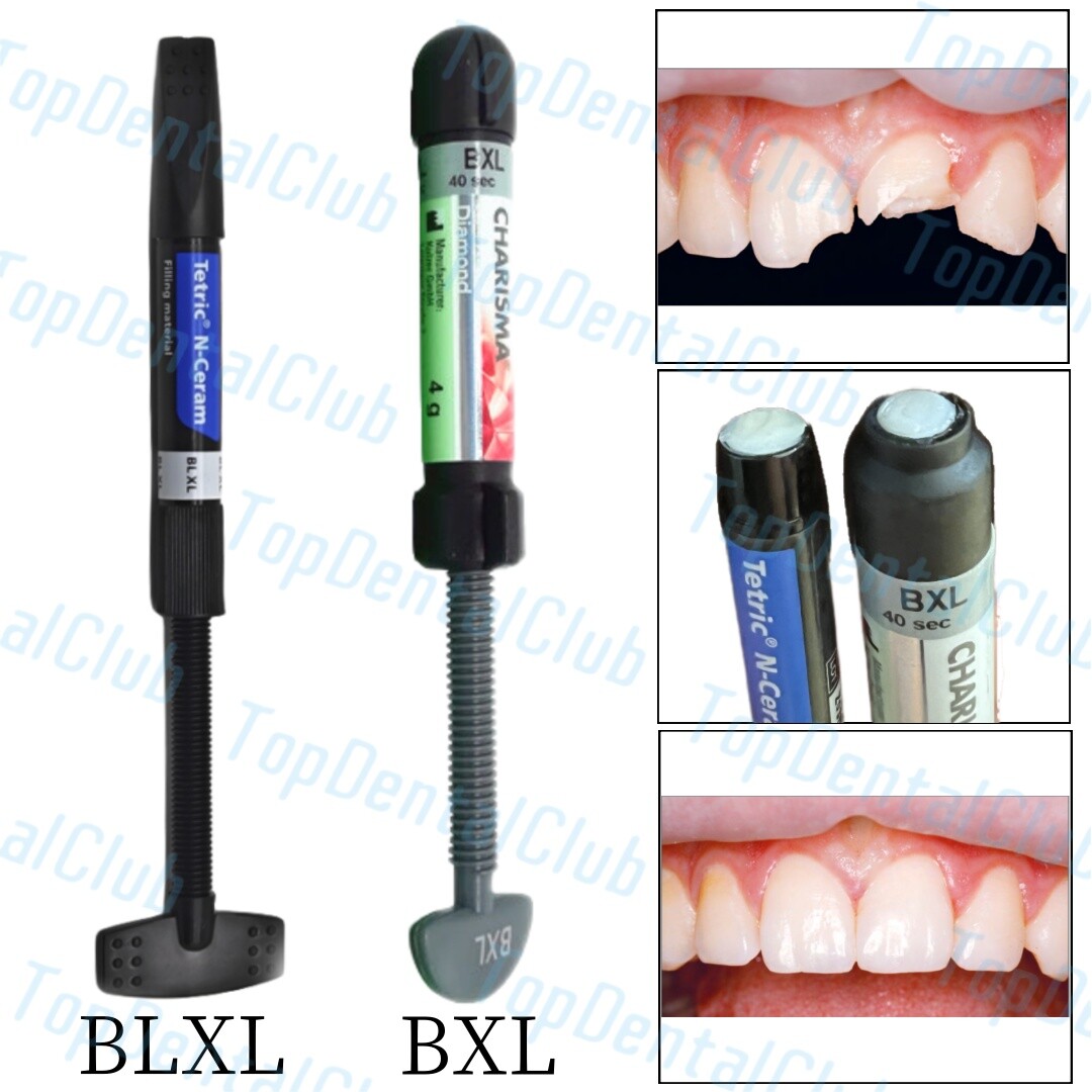 BXL/BLXL Dental Charisma Tetric N-Ceram Composite Resin Syringe Light Cure Tooth
