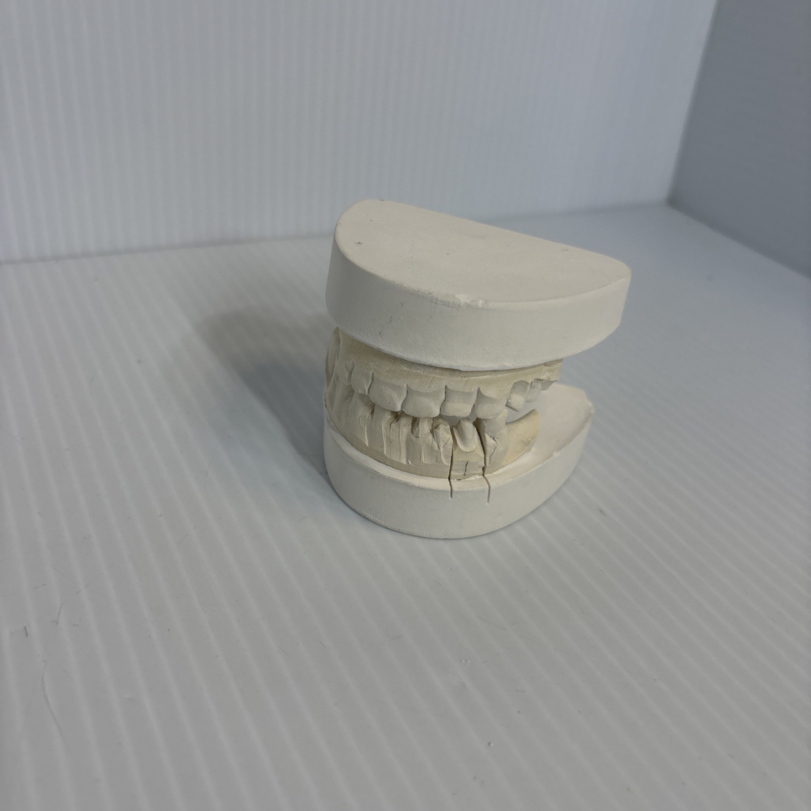 Dental Plaster Mouth,Model Adult Mold Teeth on implants,3 removable Teeth (P)#64