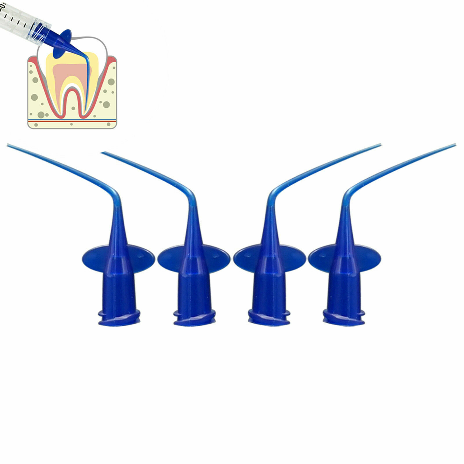Dental Endo Disposable Syringe Tips Irrigation Needle Curved Tips Flexible Blue