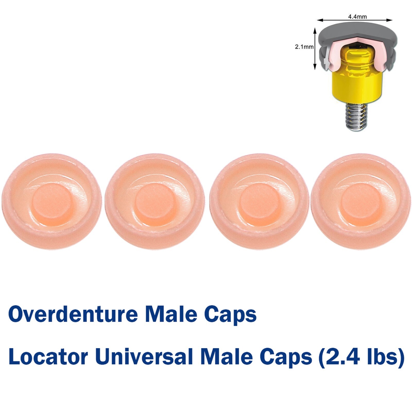Implant Multi-Unit Locator Abutment ∅4.8mm& Male Caps fits Hiossen Nobel Active