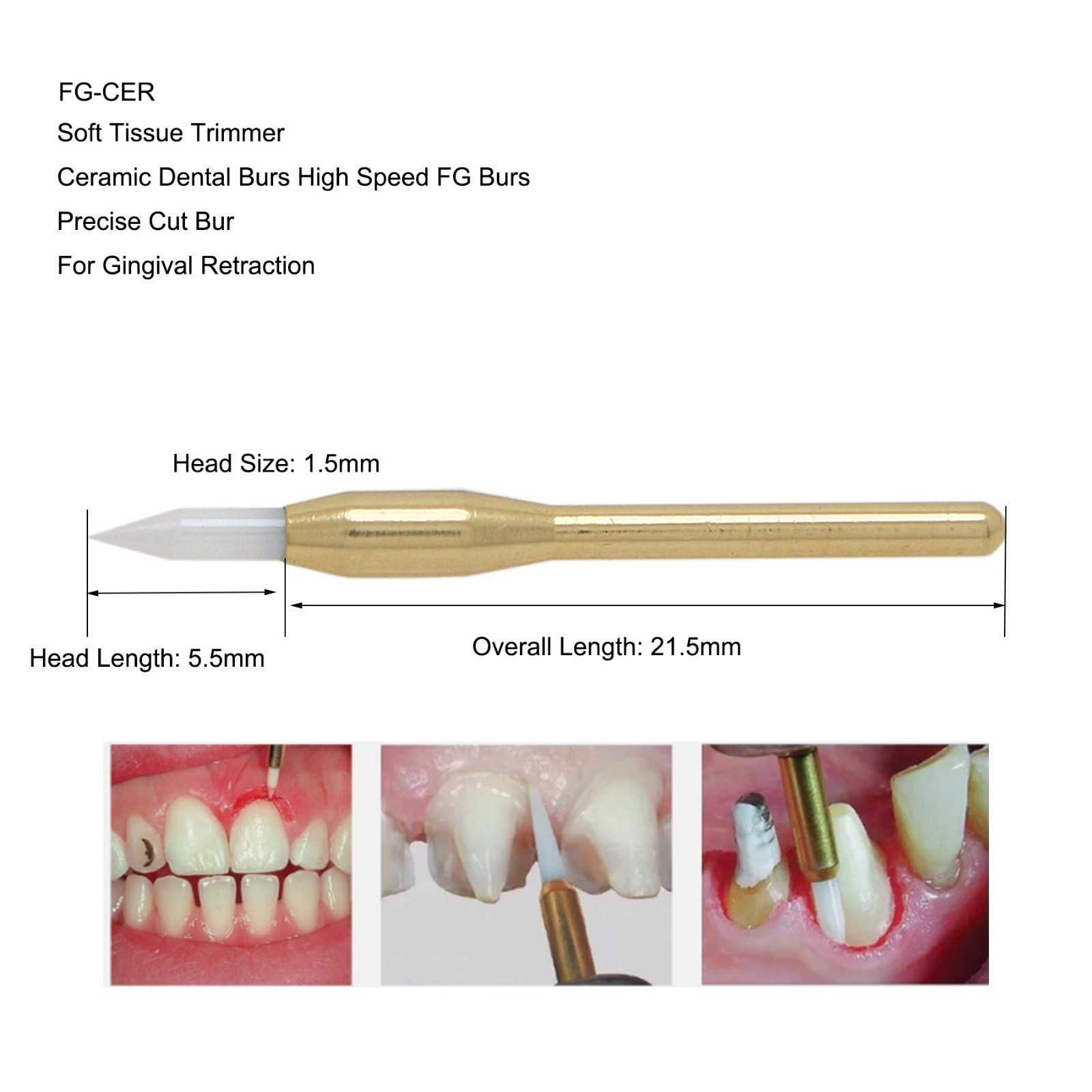 Dental Surgical FG Burs Soft Tissue Trimmer Ceramic Burs Gingival Precise Cut