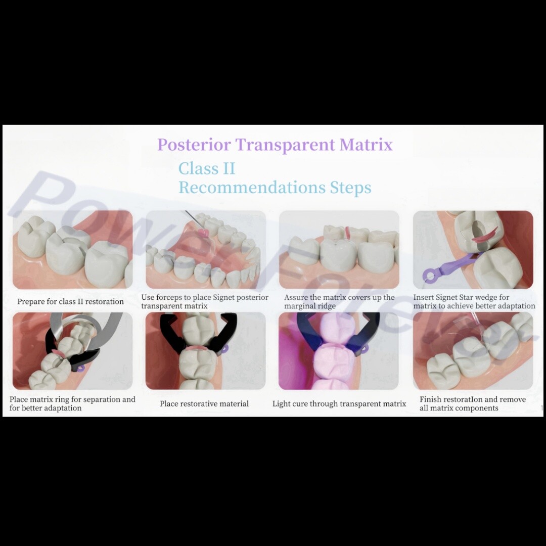 M8.0 Dental Posterior Clear Matrix Restorative BT Bow Matrices Fit BioClear