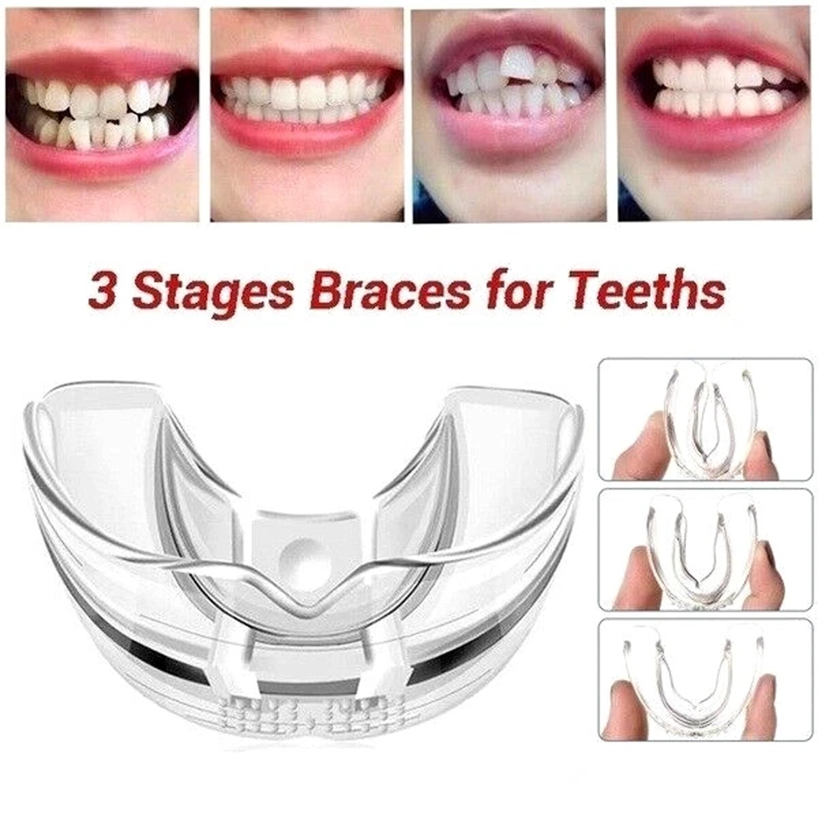 Dental Multifunctional Invisible Braces Orthodontic Smile Teeth Alignment Traine