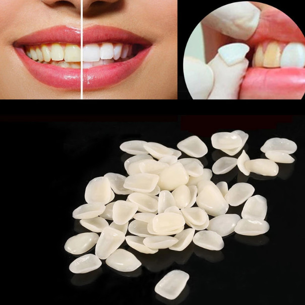 50pcs Dental Ultra-Thin Resin Teeth Veneers Anterior Dental Crown Teeth