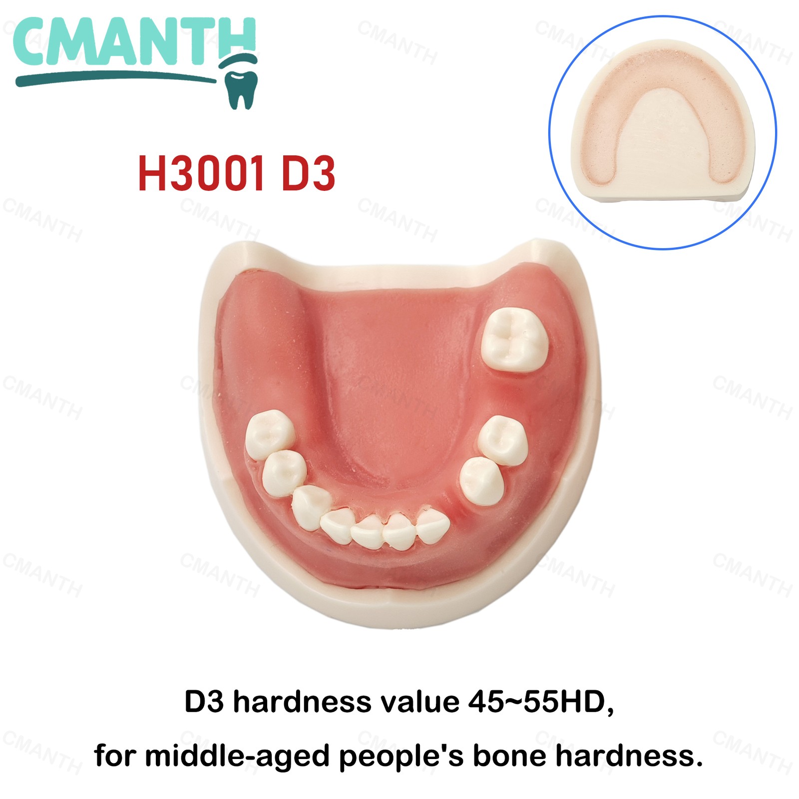 US Dental Implant Model Soft Gums Model Drilling Training Open Suture Practice