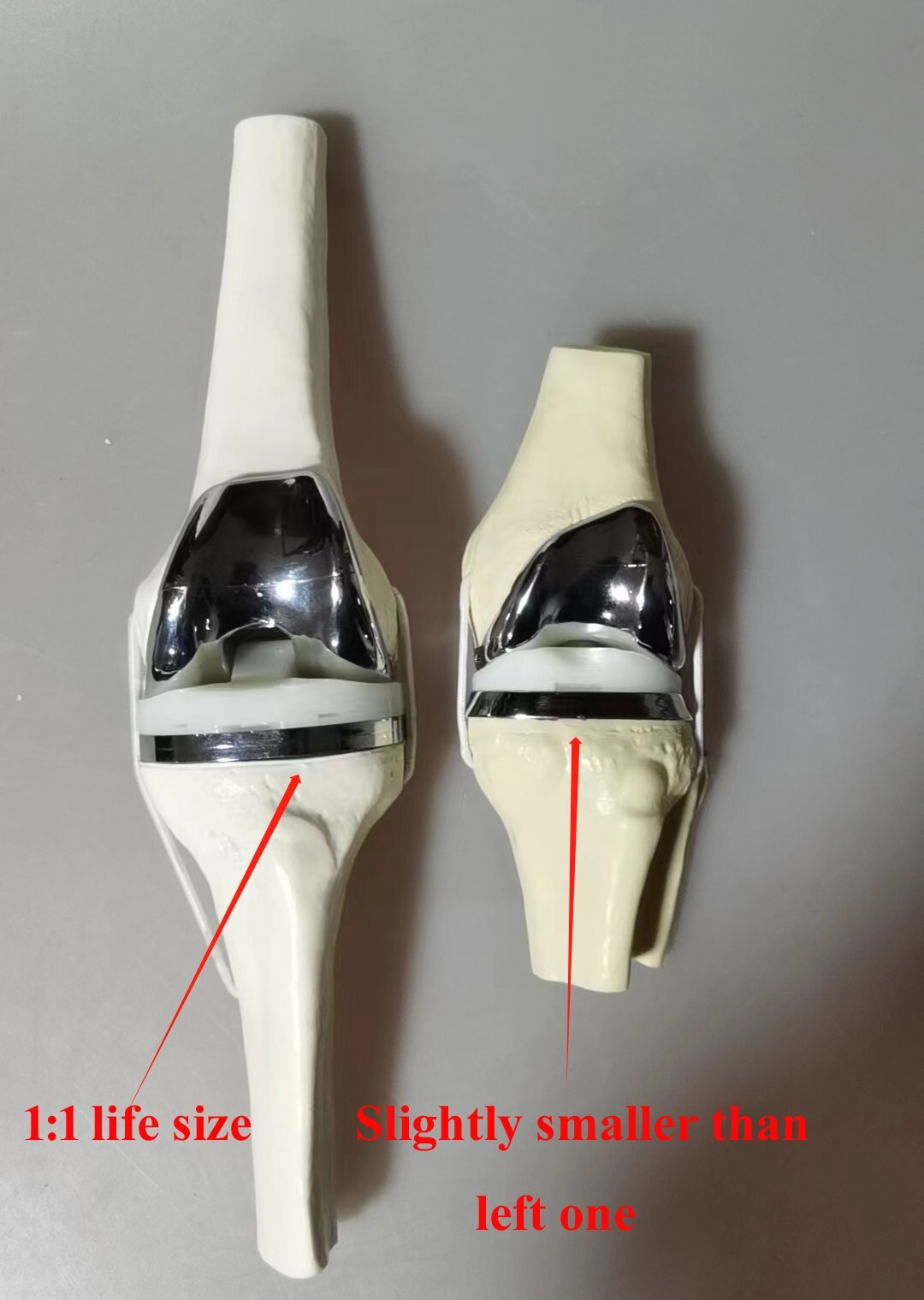Detachable Artificial Knee Prosthesis Medical Anatomical Teaching Demo Model