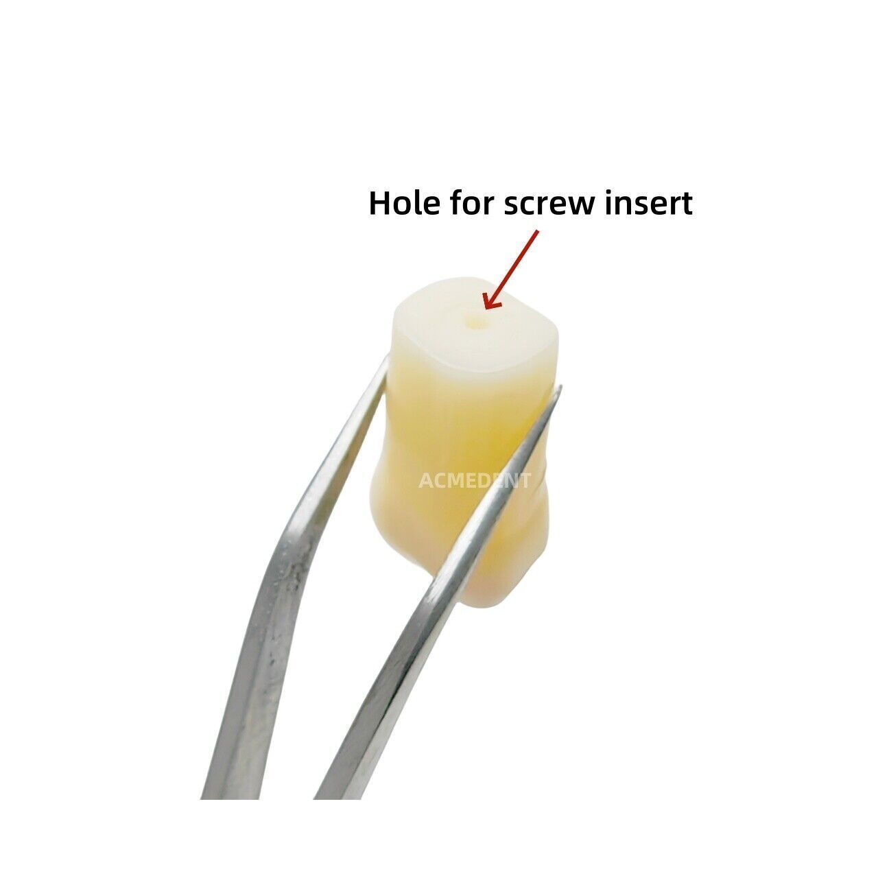 5Pcs Dental 11# Vitro Teeth Decay Caries Anterior Tooth Model Dentist School