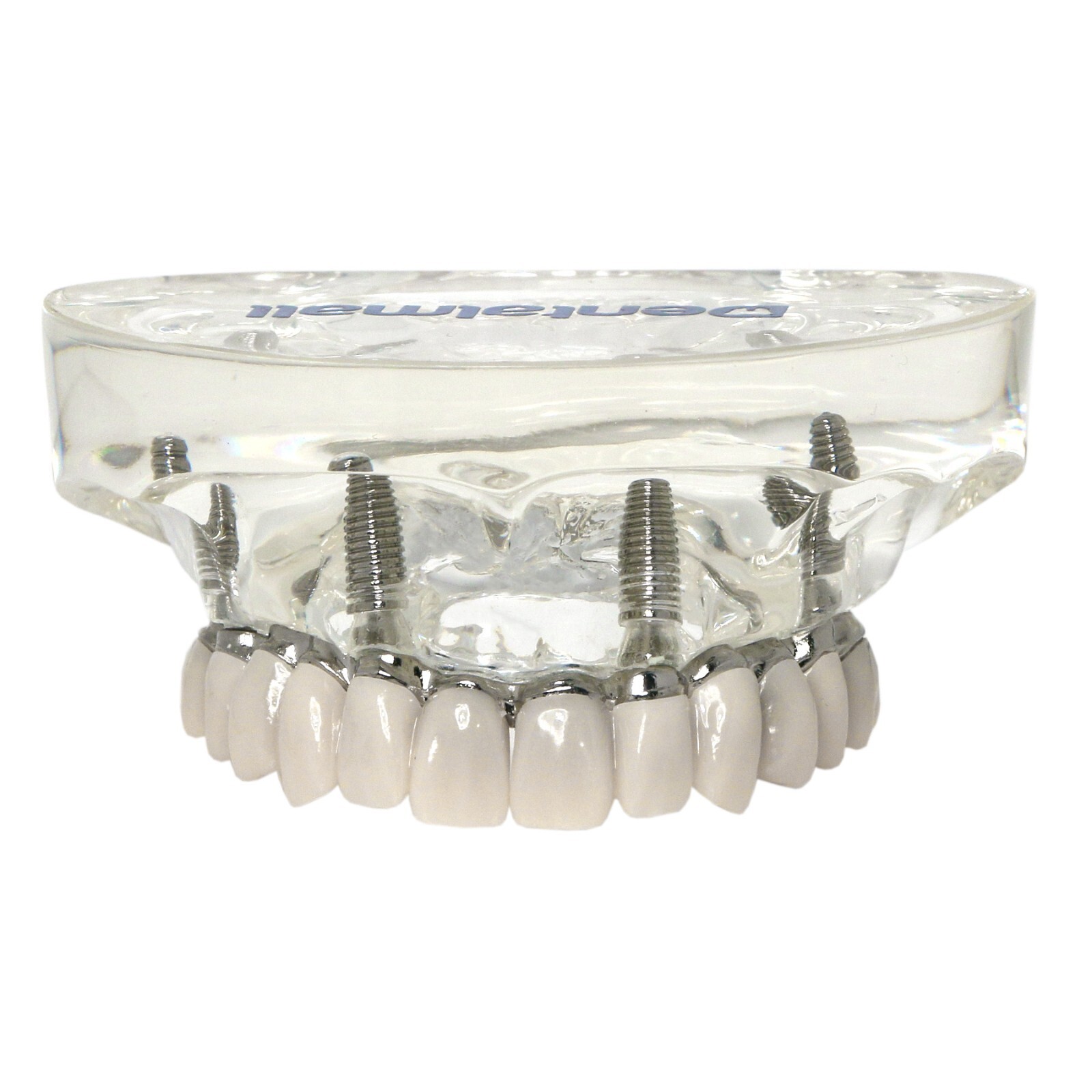 Implants Dental All-on-4 Overdenture Model Upper Jaw Restoration 4 Screws M6023