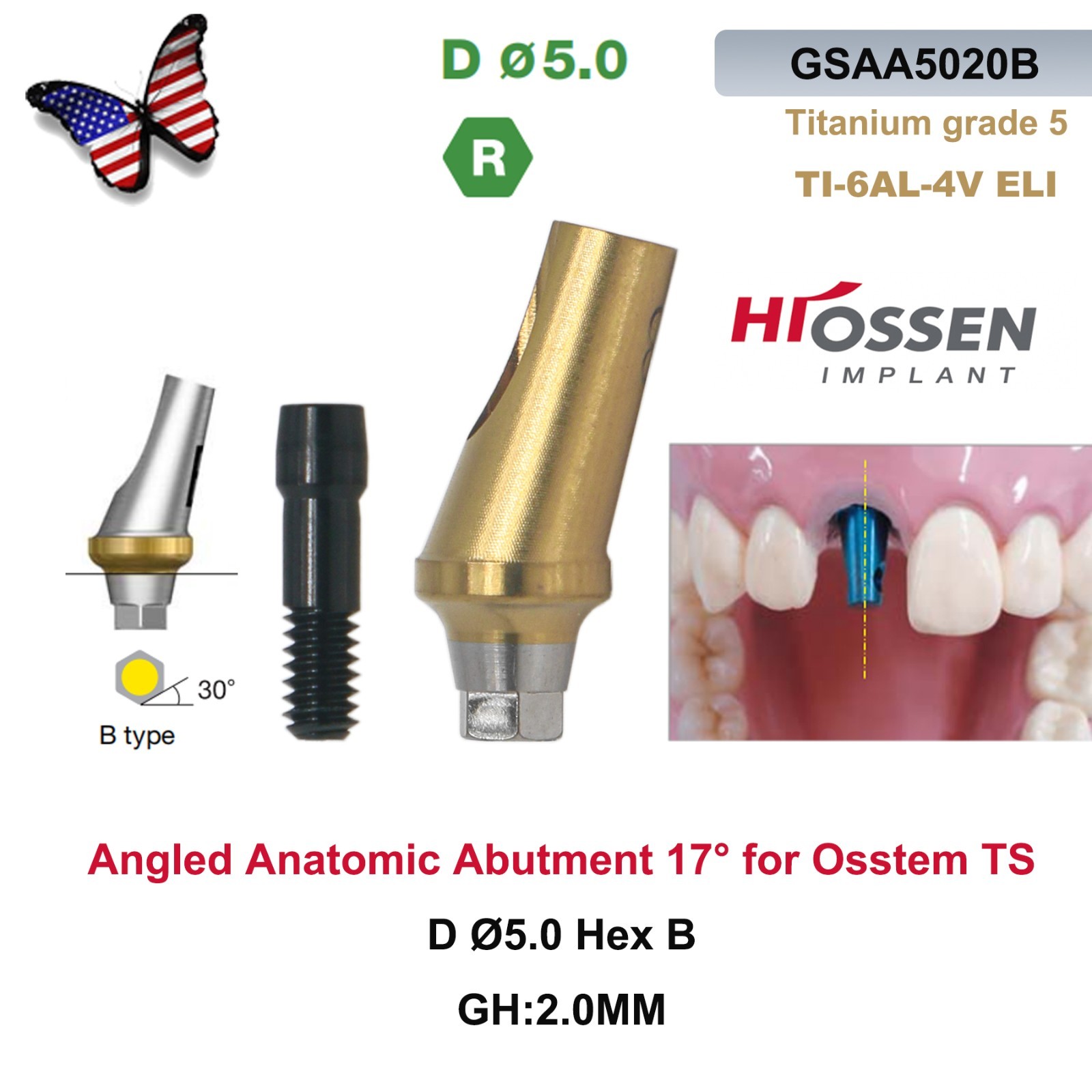 Dental 17° Angled Abutment Regular Ø5.0mm Hex A/B GH2/4 Fit Osstem TS Hiossen ET