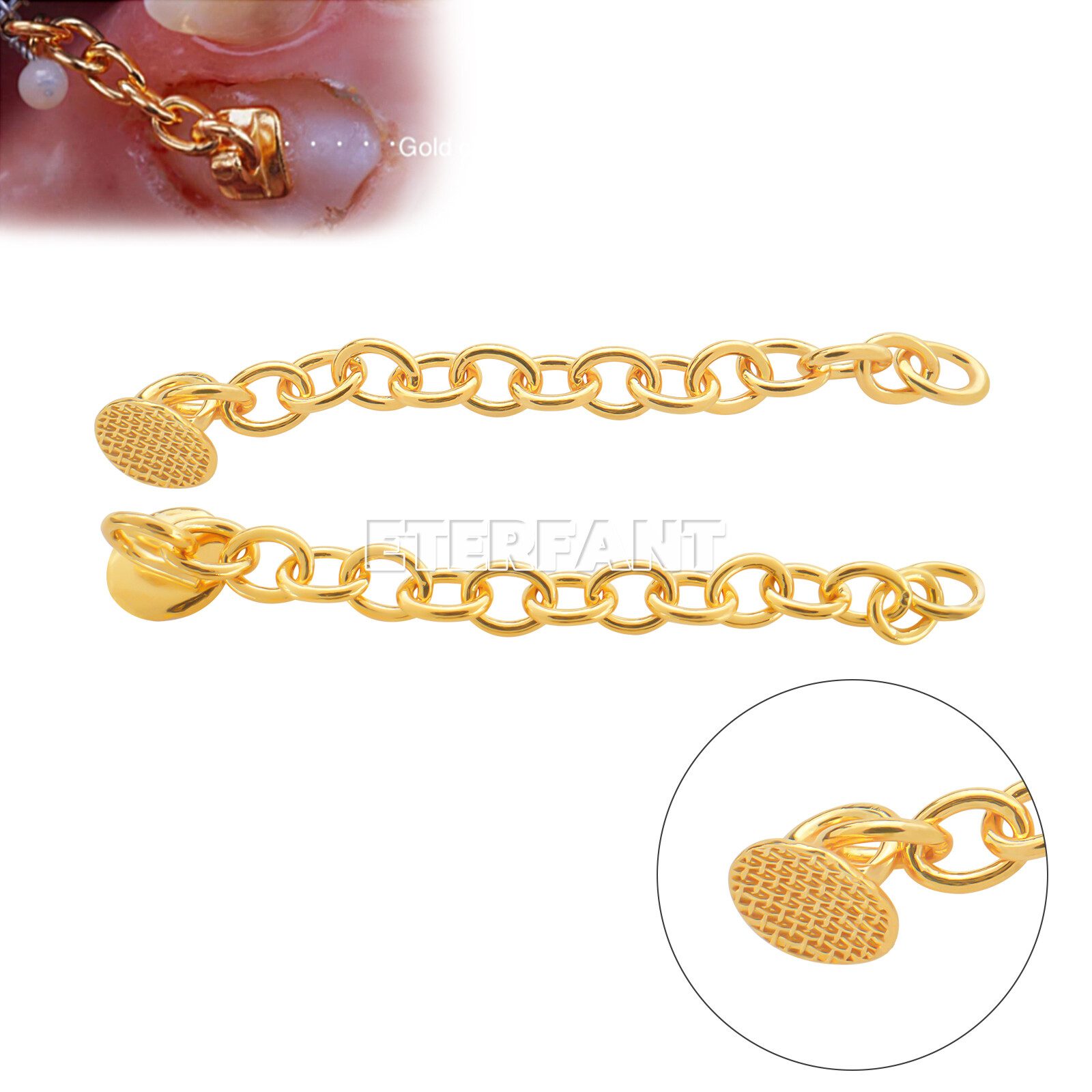 ETERFANT Dental Ortho Lingual Button Traiction Chains Round Plated Silver/Gold
