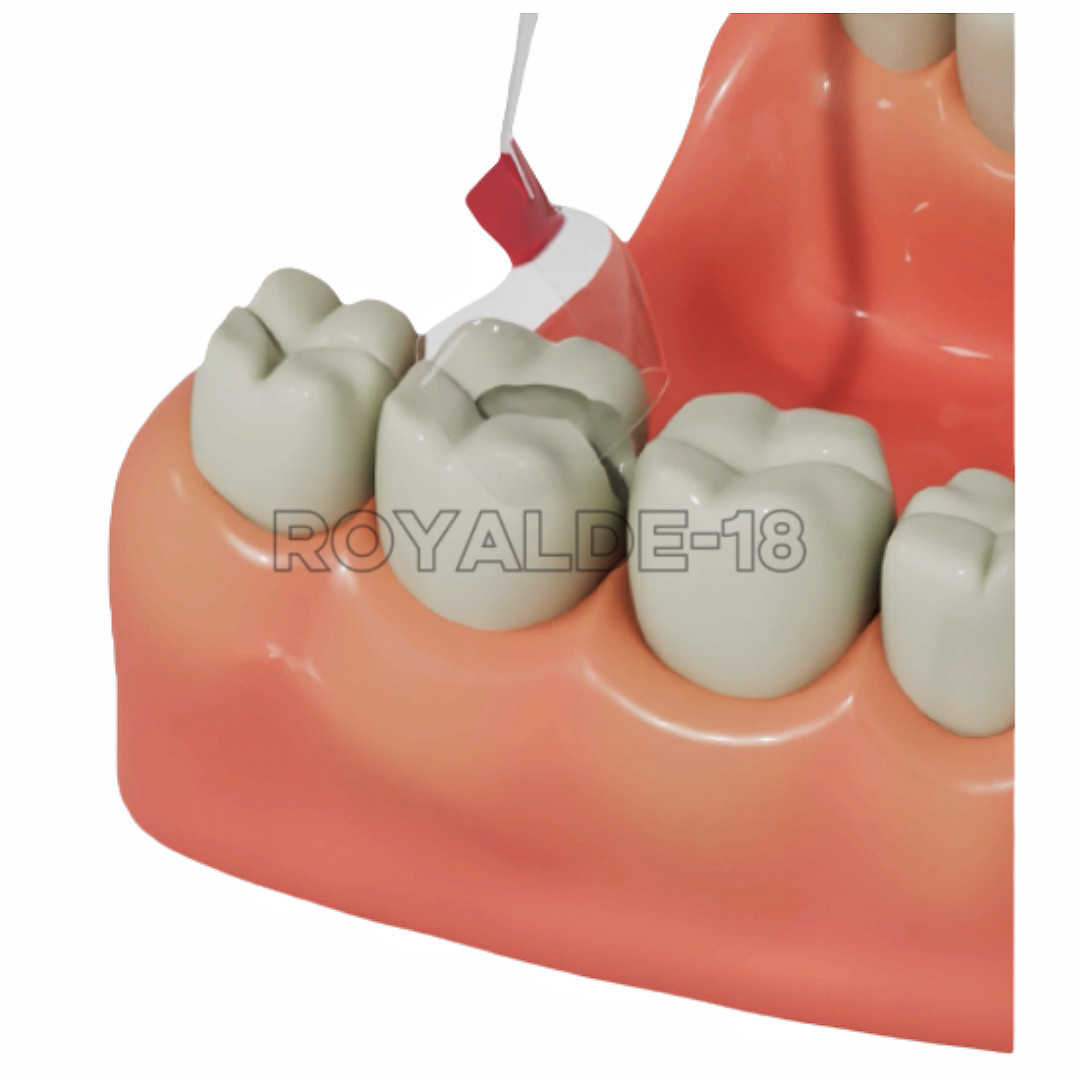 20Pcs Dental Clear Matrix Molar Mylar Matrices Similar Bioclear Matrice M4.5-8.0