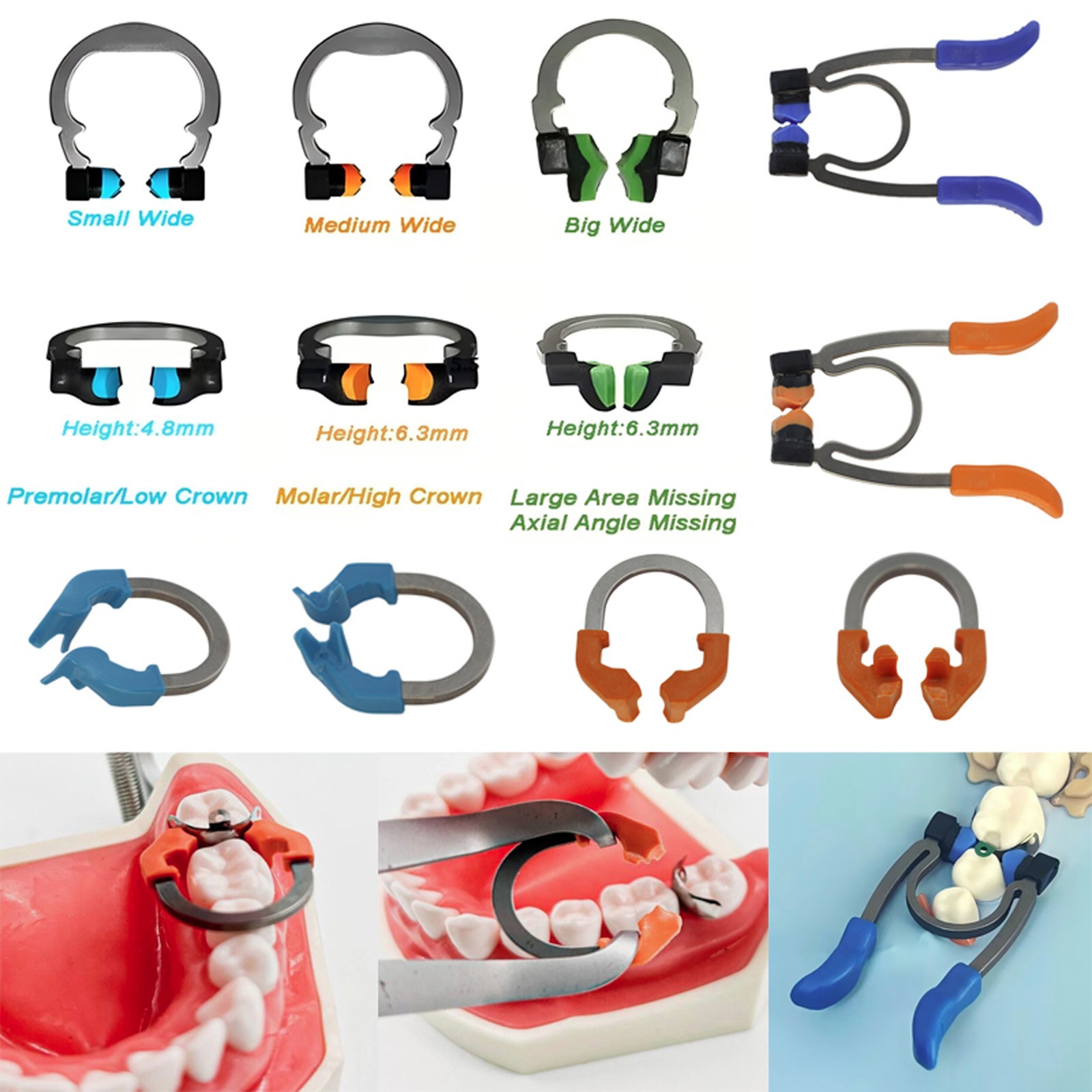 Sectional Matrix System Bands 3D Fusion Professional Kits Garrison Palodent V3