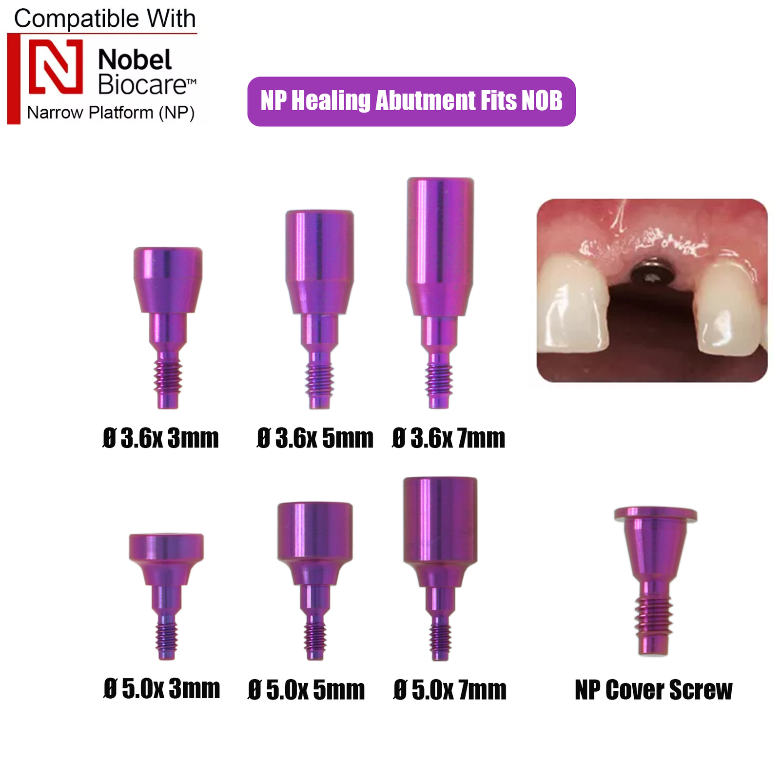 Fits Nobel Locator/Healing Abutments NP/RP Closure Cap Open/Closed Tray Conical