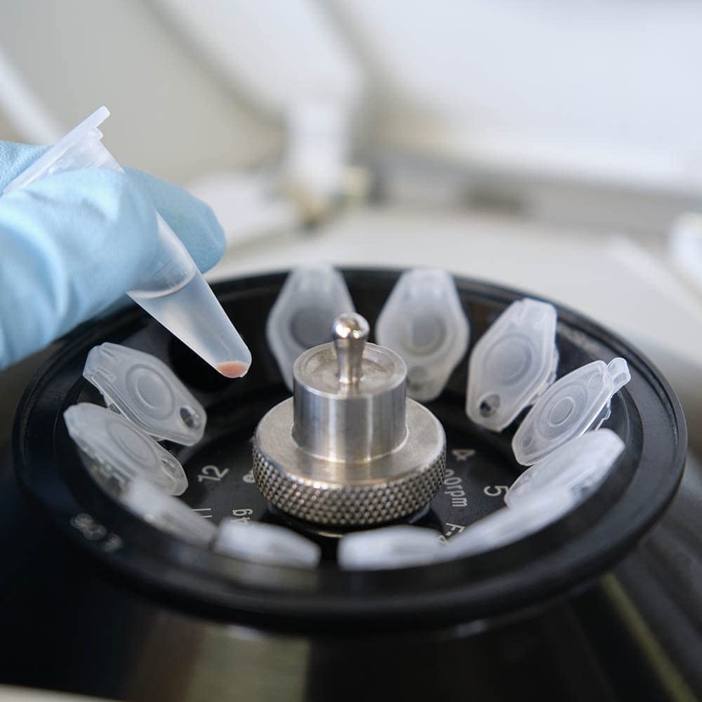 BKMAMLAB 1.5ml Microcentrifuge Tubes 500pcs, EO Sterile 500pcs