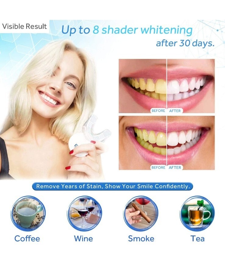 EZGO Teeth Whitening Kit Tooth Whitener with LED Light