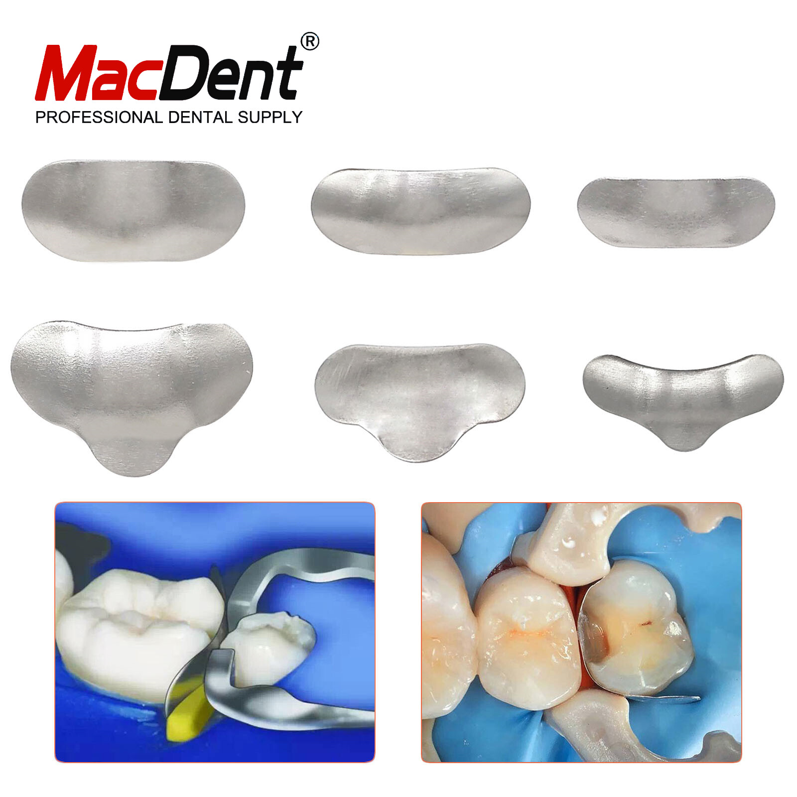 50Pcs/Box Dental Matrices Bands Metal Matrix Band Sectional Contoured Refill Box