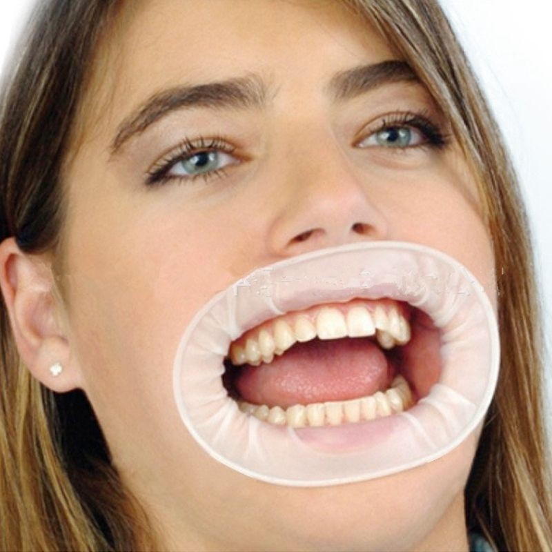 Dental Sterile Rubber Dam Cheek Retractor O-Shape Mouth Opener Fit Optragate