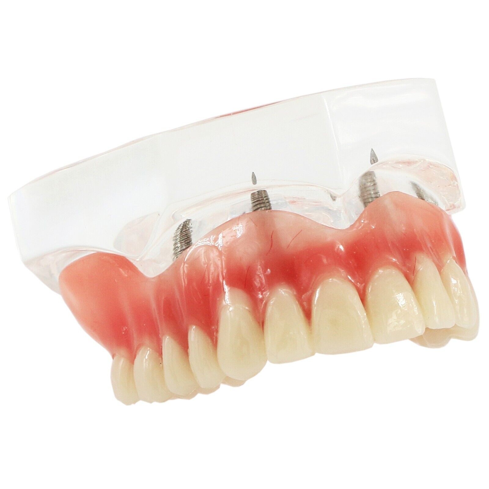 Teeth Model Dental Typodont Ortho Implant Pathological Perio Practice Demo Model
