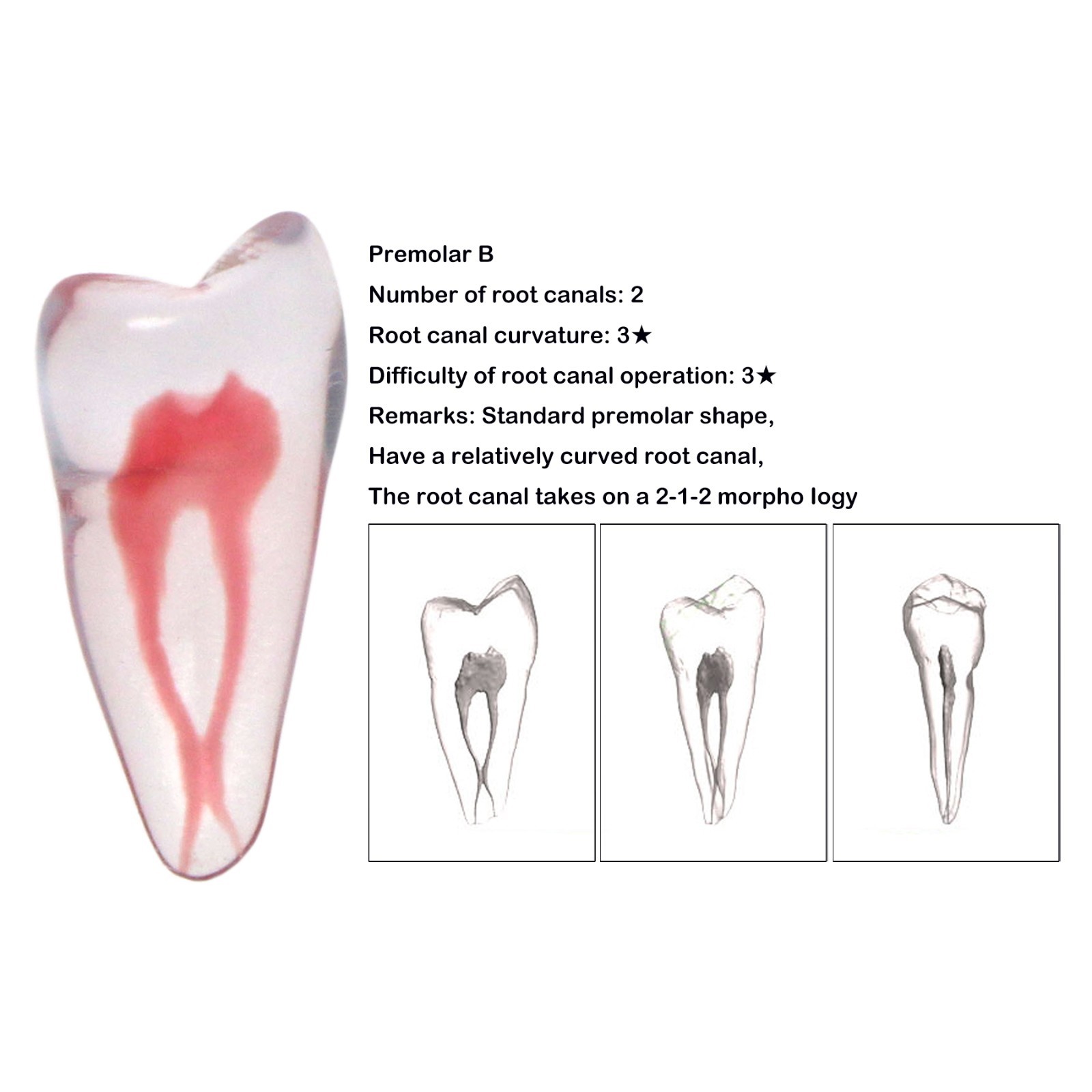 Dental Training 3D RCT Endo Tooth Model Practice Model Curved Root Resin Teeth