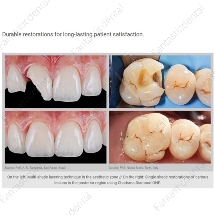 Dental KULZER CHARISMA BL Bleach Light Cure Composite Resin Nano Hybrid Opal