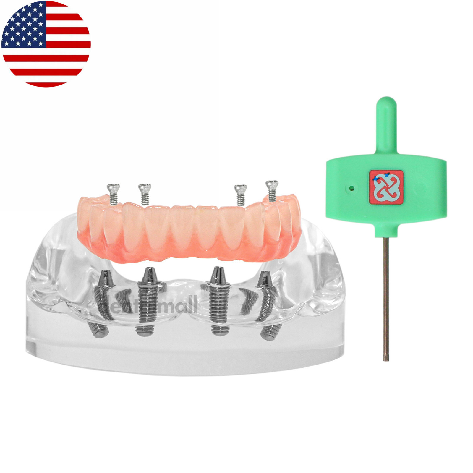 US Dental Overdenture Implant Model All-on-4 With 4 Screw Upper/Lower Clear Jaw