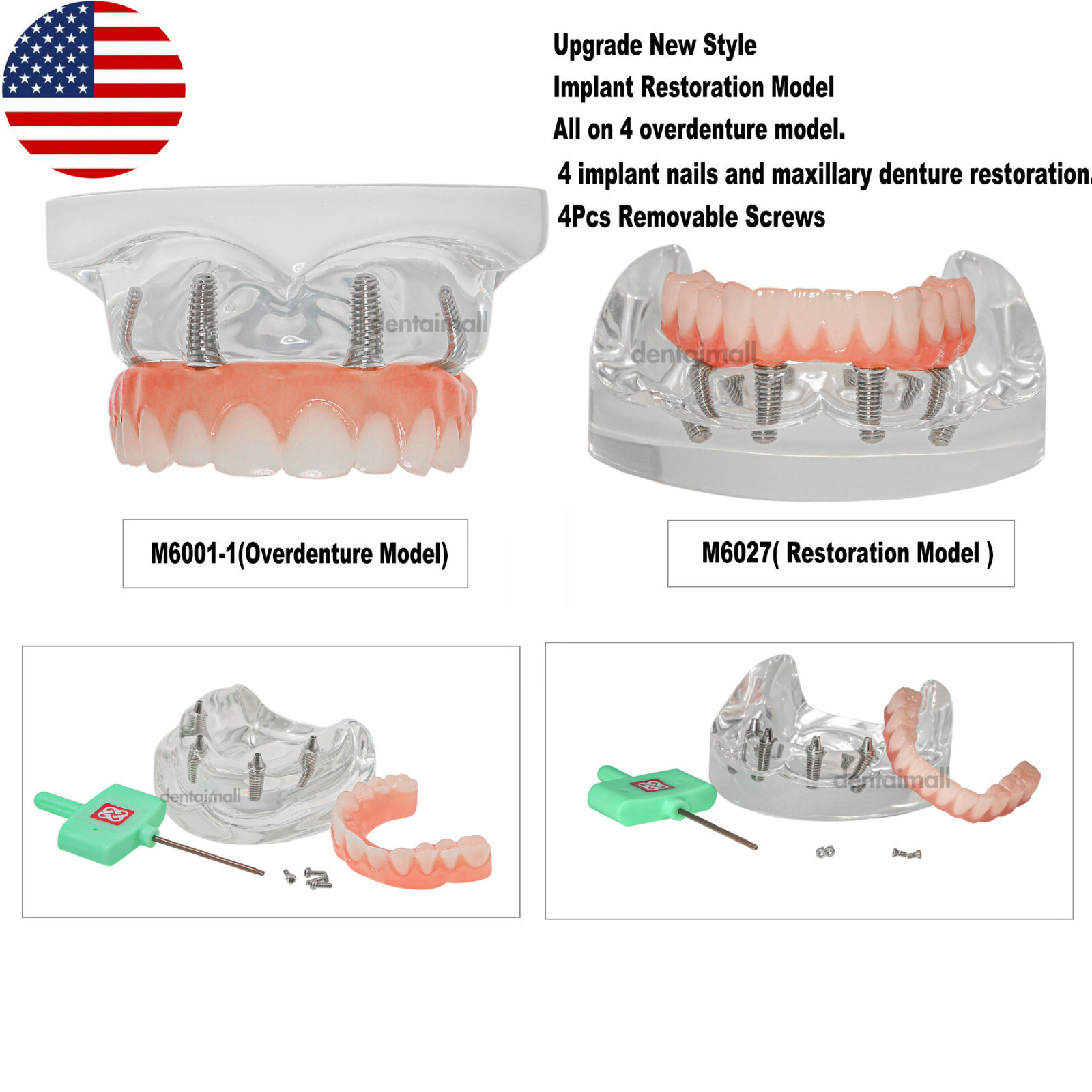 US Dental Overdenture Implant Model All-on-4 With 4 Screw Upper/Lower Clear Jaw