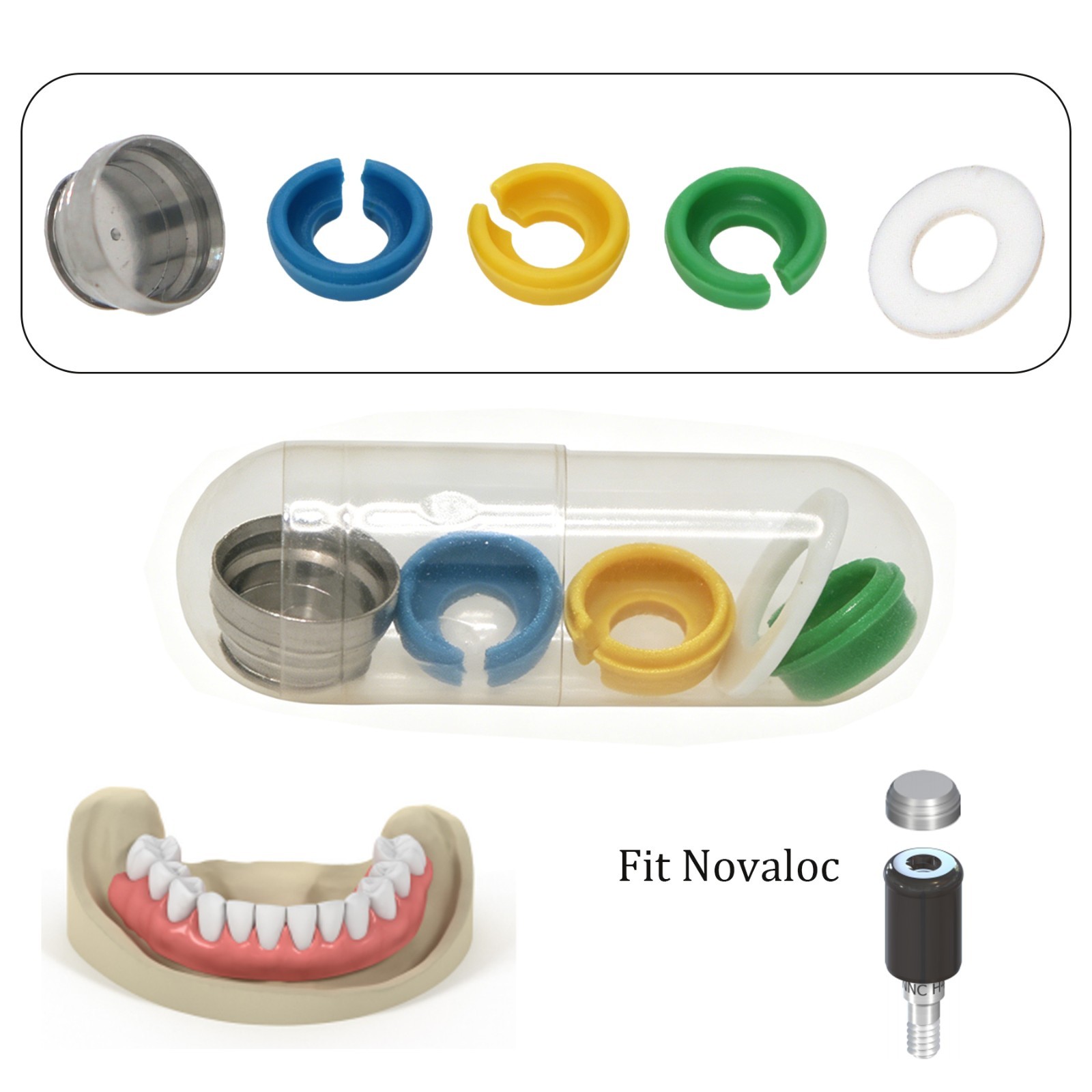 PEEK Matrix Retention Insert Titanium Housing For ITI Novaloc Retentive System