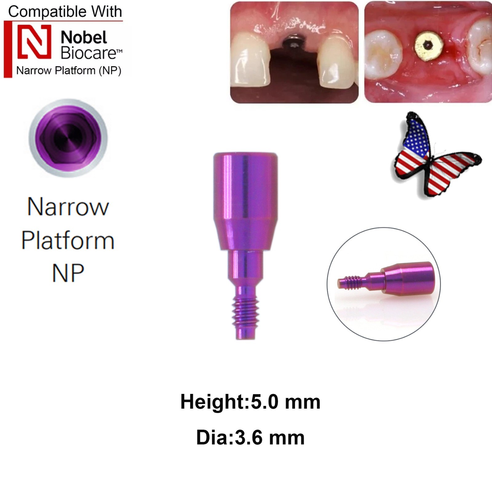 5Pcs Nobel active Healing Abutment Cover Screw Healing Screw Gum Molding Implant