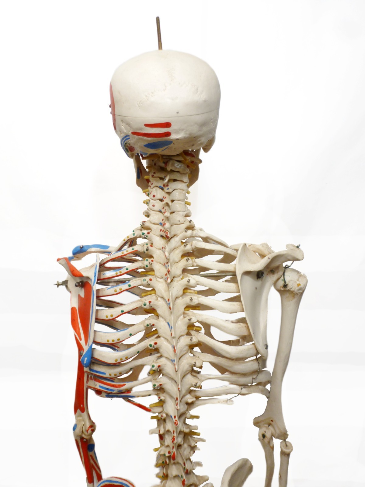 3B Scientific SAM A13 Skeleton Model Life Size Pelvic Stand Missing Muscles