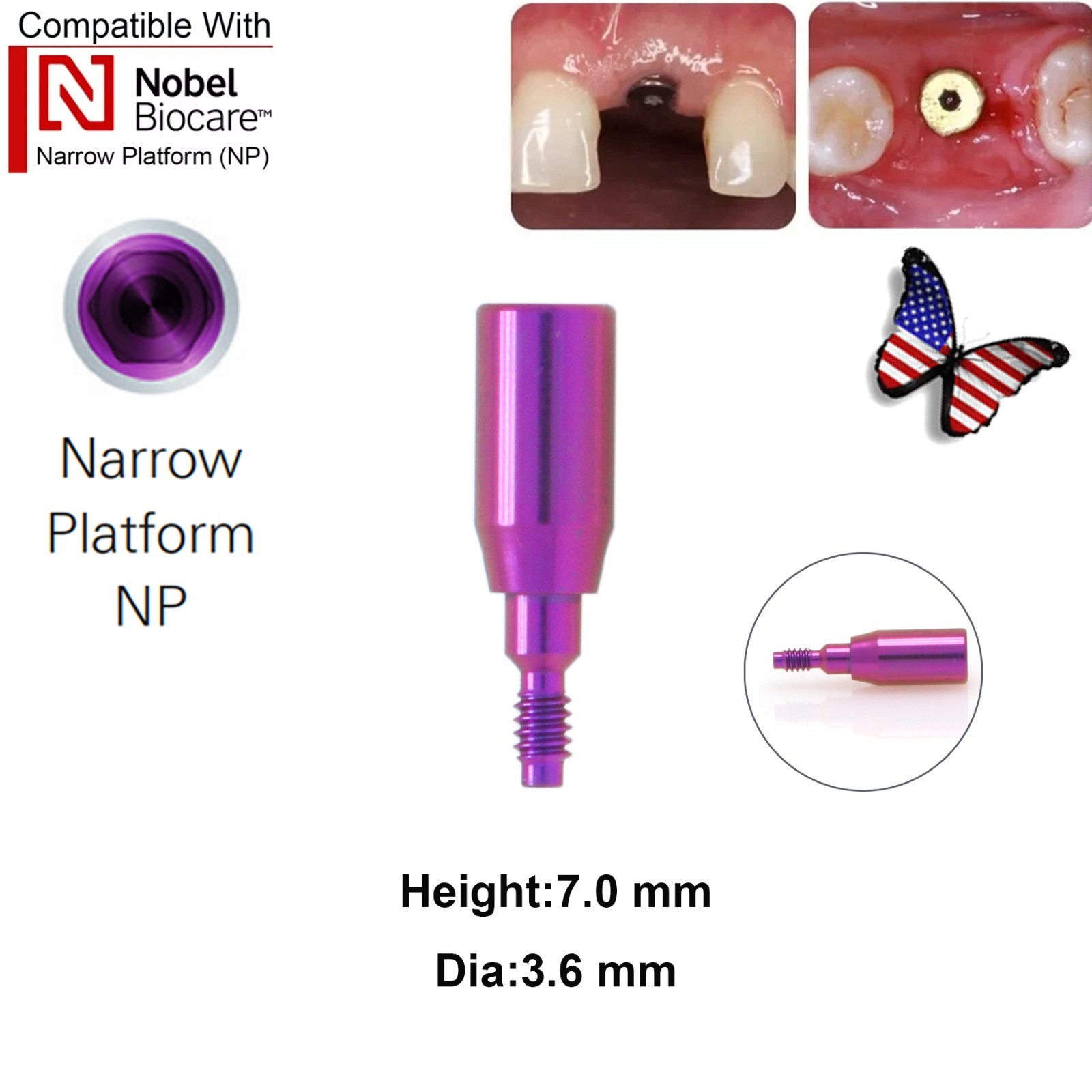 5Pcs Nobel active Healing Abutment Cover Screw Healing Screw Gum Molding Implant