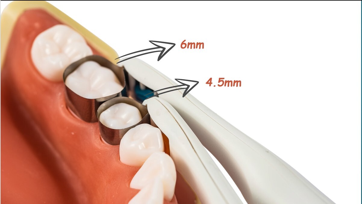 Adjust Dental Pro Matrix Holder Molar/Premolar Matrices Bands Restoration Teeth