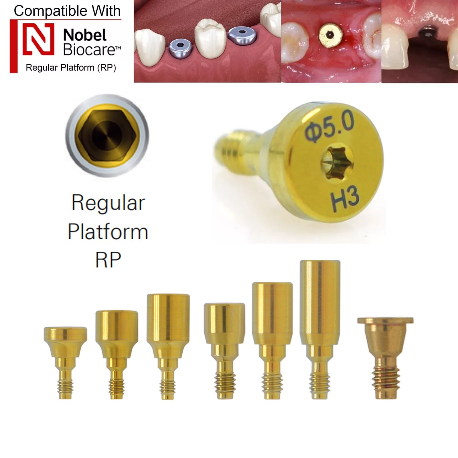 5Pcs Nobel active Healing Abutment Cover Screw Healing Screw Gum Molding Implant