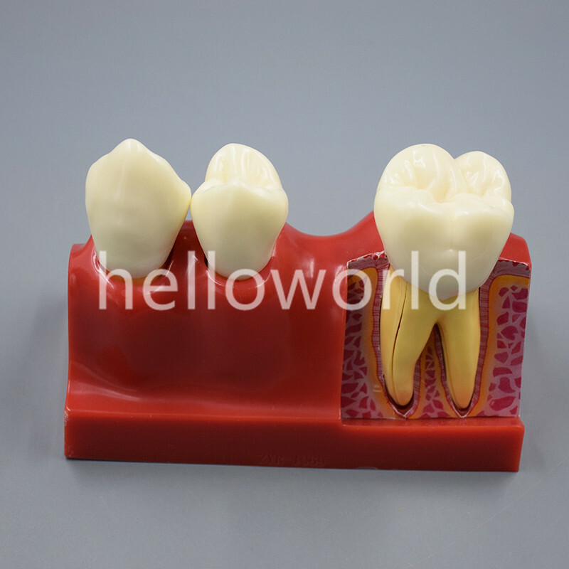 Dental Endodontic Study Teeth Model 4 Times Tooth Anatomy Anatomical Models