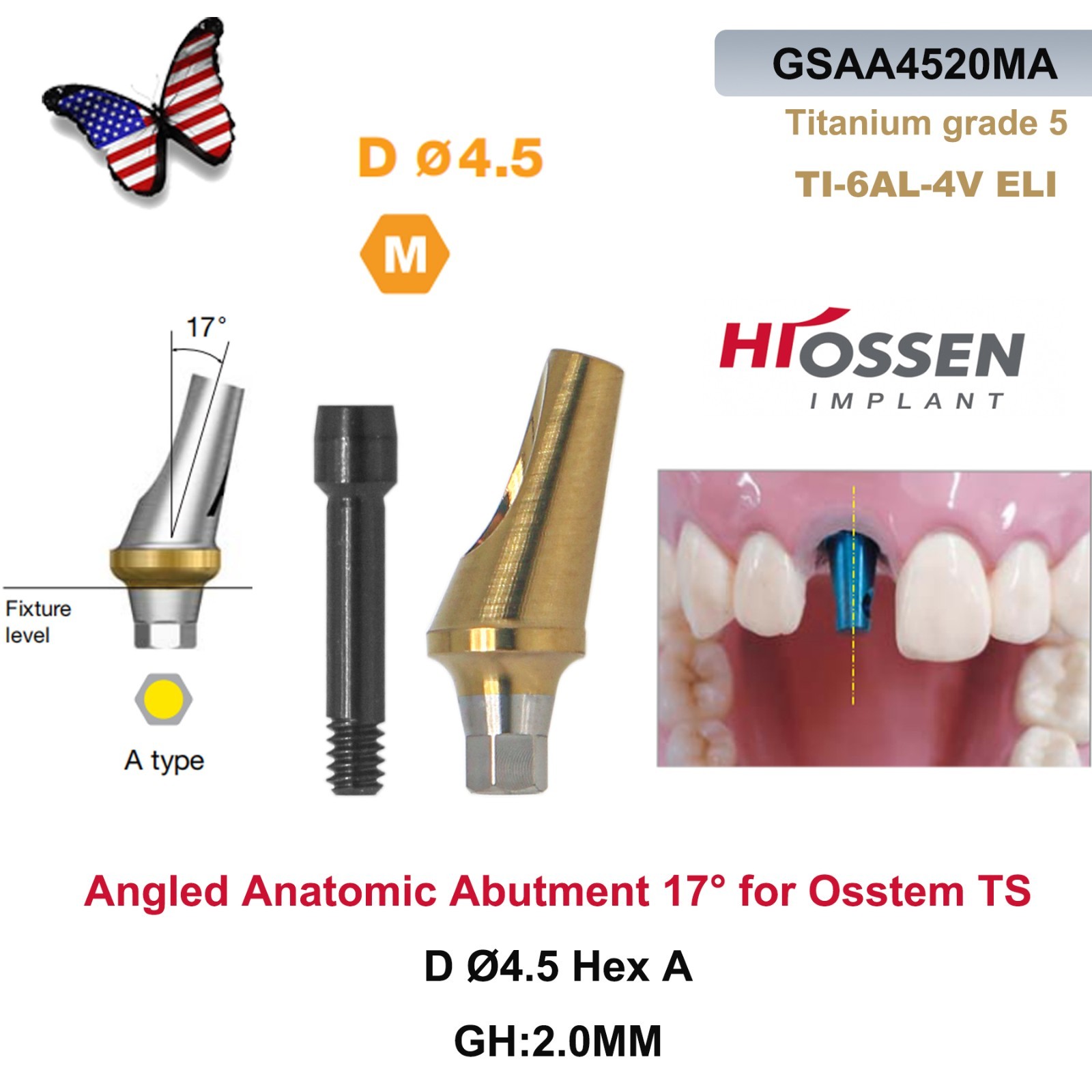 US Dental Straight Transfer & 17° Angled Anatomic Abutment Fit Hiossen/Osstem