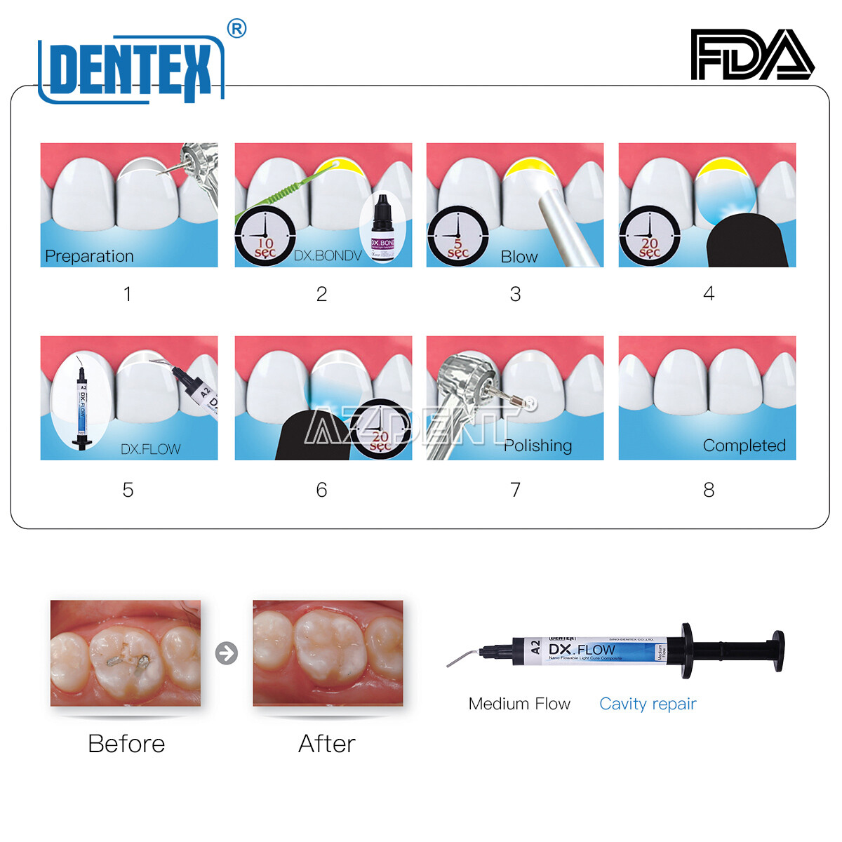 Dental Universal Curing Light Composite Resin A1A2A3A3.5B1B2/Flowable /Syringe