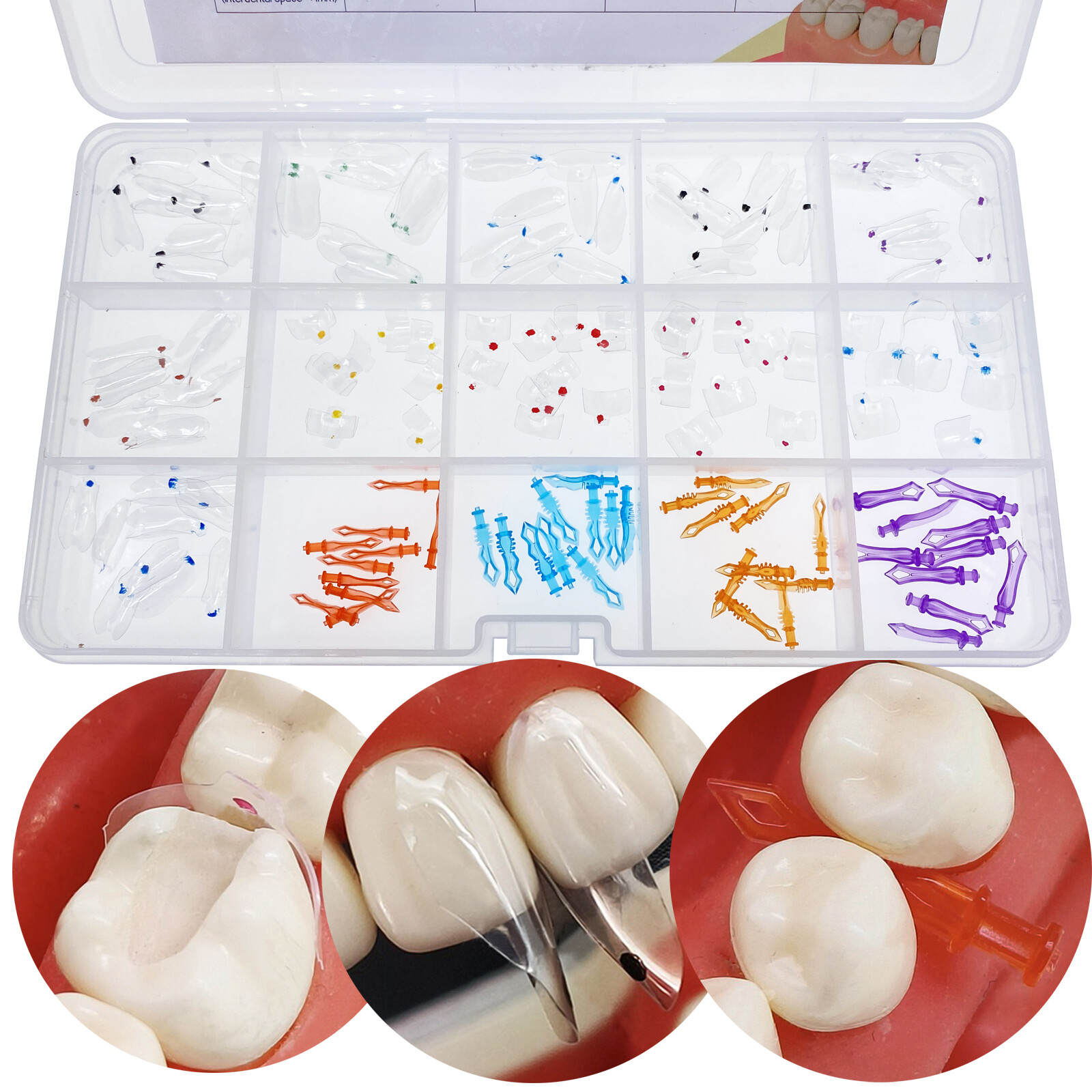 Dental Clear Matrix Anterior Posterior Restorative BT Bow Matrices Fit BioClear